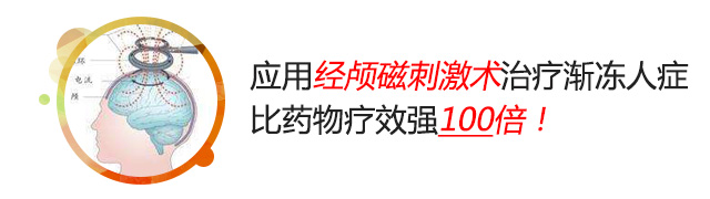 经颅磁刺激术怎样治疗渐冻人症?